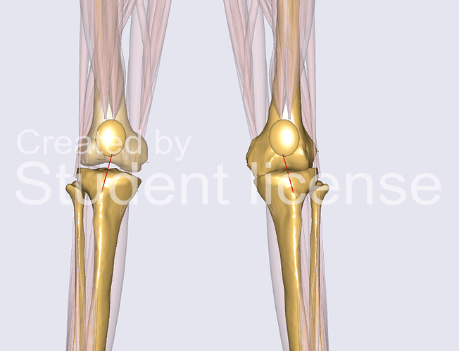 Knie_Spalt_stehend