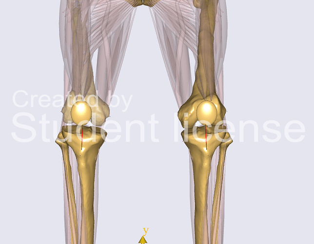 Knie_Spalt_gebeugt