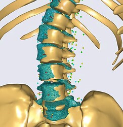 Morphed_Drive_to_target_IntervertebralDistance